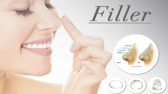 Giới trẻ đổ tiền bơm Filler: Đừng để đau mới thấu!