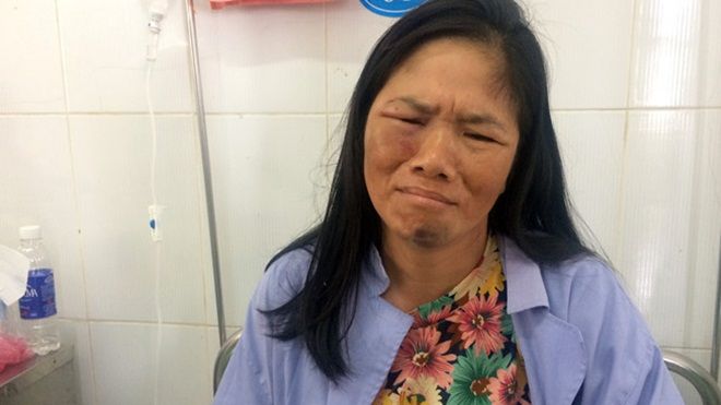 2 phụ nữ bán tăm quyết làm rõ đúng sai sau vụ bị đánh nhập viện