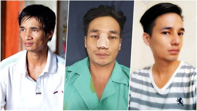 Bất ngờ với nhan sắc của Lệ Rơi sau phẫu thuật thẩm mỹ