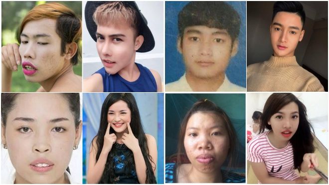 Đâu chỉ có Đức Phúc, vẫn còn rất nhiều gương mặt đẹp đến ngỡ ngàng nhờ phẫu thuật thẩm mỹ