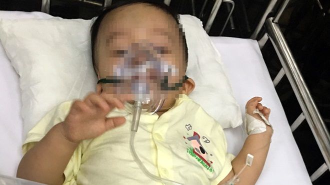 Sức khỏe bé 1 tuổi bị bạo hành chuyển biến xấu, sẵn sàng phẫu thuật