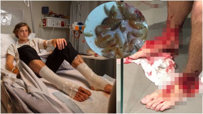 Sự thật về sinh vật biển ăn thịt người đang khiến cả cộng đồng mạng Việt hoang mang