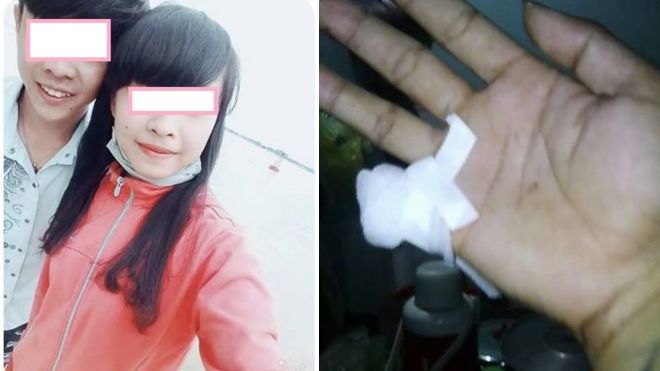 Bị bạn gái phản bội, chàng trai chặt ngón tay để níu kéo tình yêu