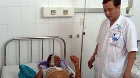 11 khách ăn cưới bỏng nặng do bếp cồn bùng cháy