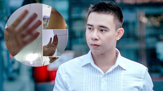 Đông Hùng bị chém do gánh nợ tiền tỷ thay mẹ?