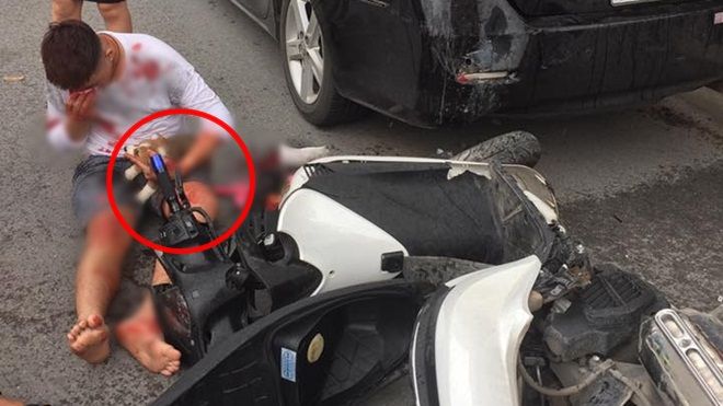 Tai nạn trọng thương, nam thanh niên chỉ ôm chặt chó và gọi bác sĩ thú y