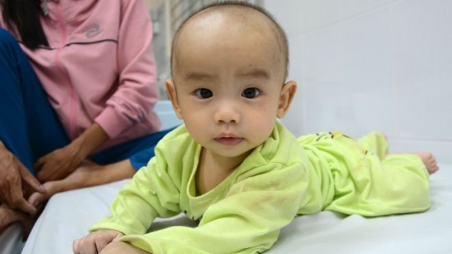 Bé trai 5 tháng thoát nạn kỳ diệu trong tai nạn xe Cúc Tùng