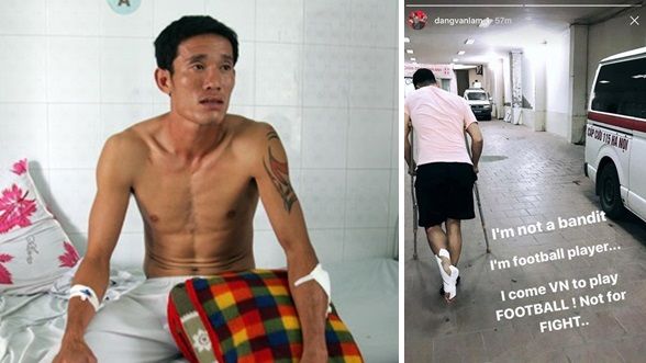 6 vụ cầu thủ Việt bị rượt chém gây rúng động làng bóng đá