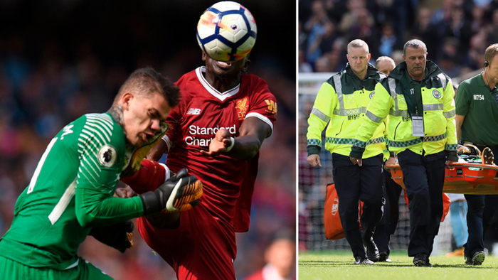 Thủ thành Ederson mặt 'chằng chịt' sẹo sau khi lĩnh cú đạp của Mane