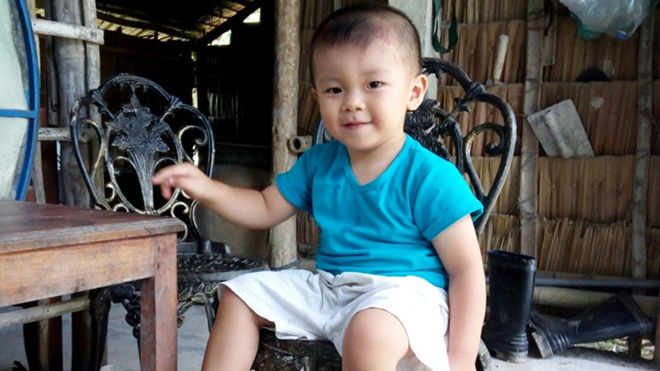 Bé trai từng bị đâm xuyên não đã lên 2 tuổi và rất kháu khỉnh