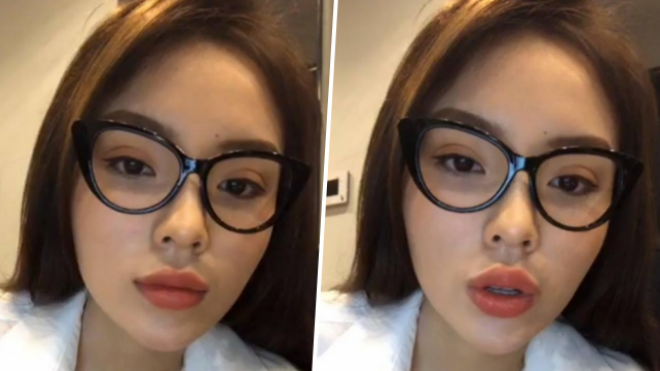 Cằm nhọn - môi tều chưa đủ, Kỳ Duyên lại tiếp tục 'đụng dao kéo' để có mắt hai mí rõ ràng?