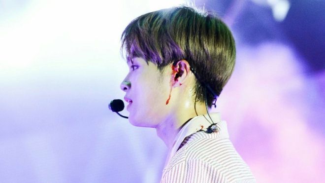 Thành viên Wanna One chấn thương, netizen phẫn nộ khi quản lí bắt ở lại chụp ảnh