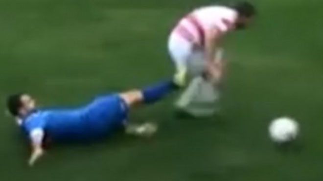 Chấn thương hi hữu khiến cầu thủ phải cắt tinh hoàn