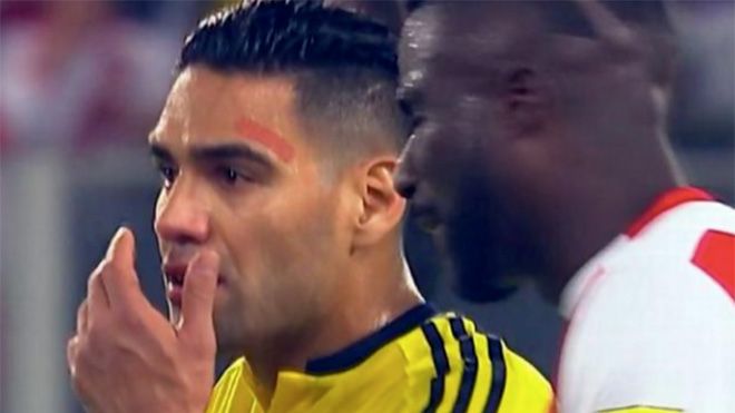 Dàn xếp tỷ số trắng trợn ở World Cup: Falcao nói điều bí mật  với cầu thủ Peru
