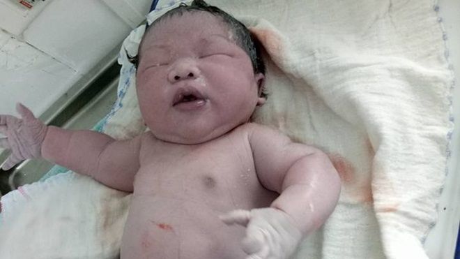 Bé trai sơ sinh ‘khủng’ nhất Việt Nam, nặng tới 7,1kg ở Vĩnh Phúc