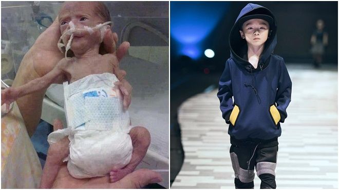 Câu chuyện ấm áp của cậu bé 6 tuổi khi sinh chỉ nặng 1.2kg qua lời kể của mẹ