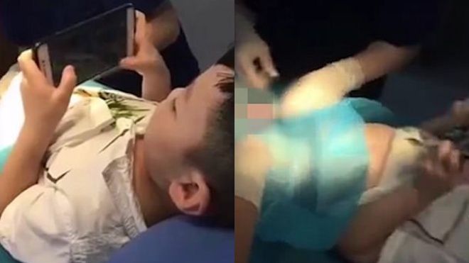 Bệnh viện Trung Quốc giảm giá phí phẫu thuật bao quy đầu cho trẻ biết… chơi điện tử