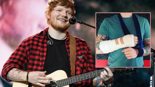 Ed Sheeran - Chủ nhân hit 'Shape of You' huỷ tour châu Á vì gặp tai nạn