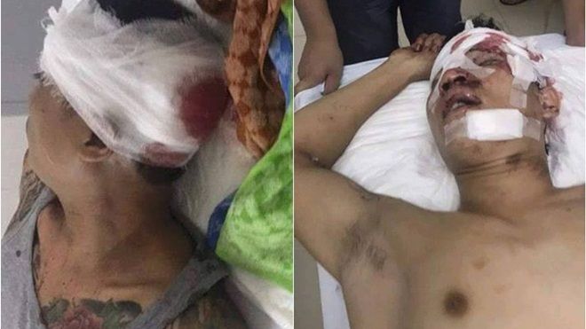 Đang ngồi uống bia, hai thanh niên bị nhóm 10 người cầm hung khí tấn công nguy kịch