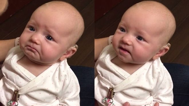 Em bé khiếm thính xúc động bật khóc khi lần đầu tiên nghe được giọng nói của mẹ