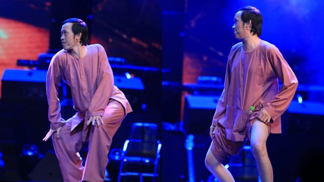 NSƯT Hoài Linh hài hước kéo cao quần khoe đôi chân thon