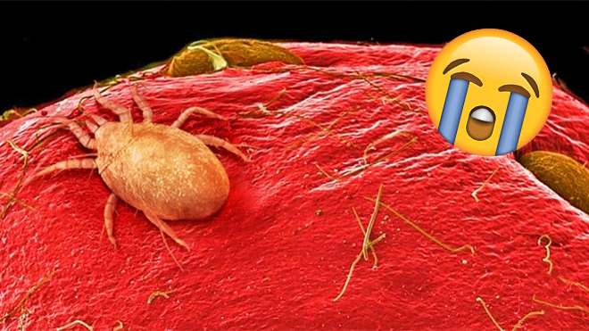 16 hình ảnh đồ ăn dưới kính hiển vi chắc chắn sẽ khiến bạn nổi da gà