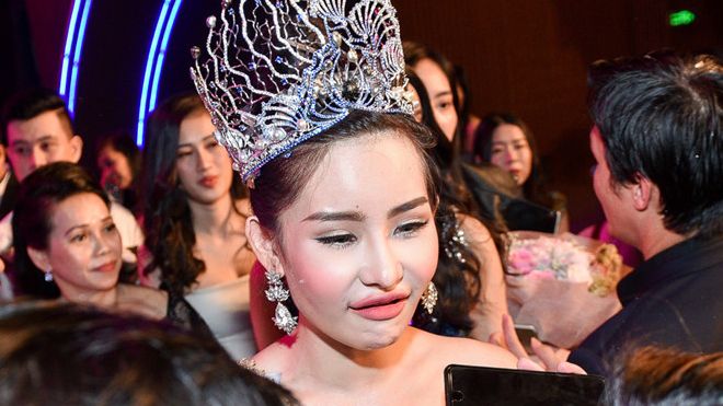 Cục NTBD yêu cầu giải trình việc đương kim Hoa hậu Đại dương phẫu thuật thẩm mỹ