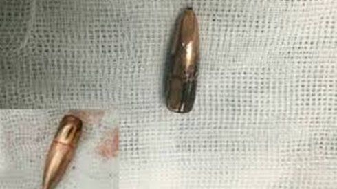 Nghi vấn đạn lạc rơi trúng cổ nam thanh niên nằm trong nhà ở Hoà Bình