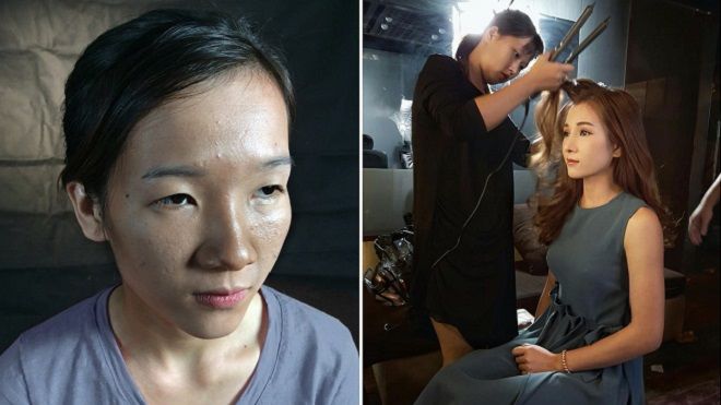 Cô gái bị người yêu bỏ vì 'mắt lươn' lên tiếng sau nghi vấn giả xấu để được PTTM