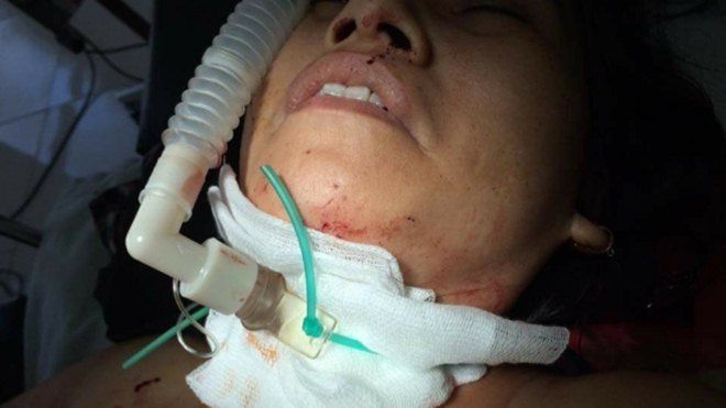 Vụ nữ chủ tiệm tóc bò ra đường kêu cứu vì bị cứa cổ: Gây án xong, nghi phạm 16 tuổi vẫn đến nghe ngóng