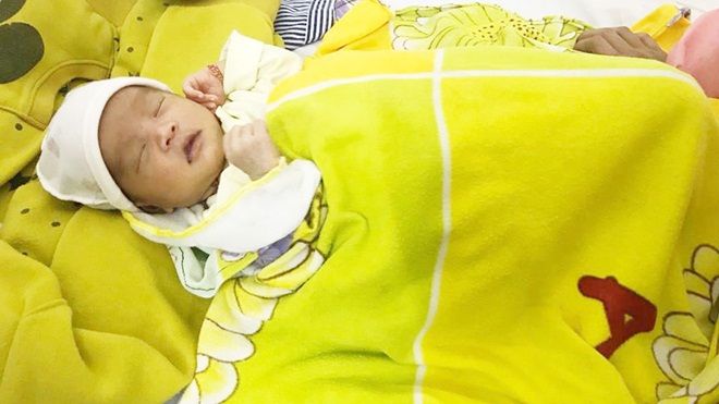 Bé gái 16 ngày tuổi bị loét thủng giác mạc vì người nhà nhỏ sữa mẹ vào 2 mắt