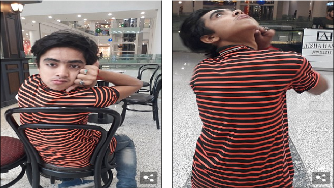 Lạ lùng cậu bé 'người cú' có khả năng xoay đầu 180 độ như trong phim kinh dị