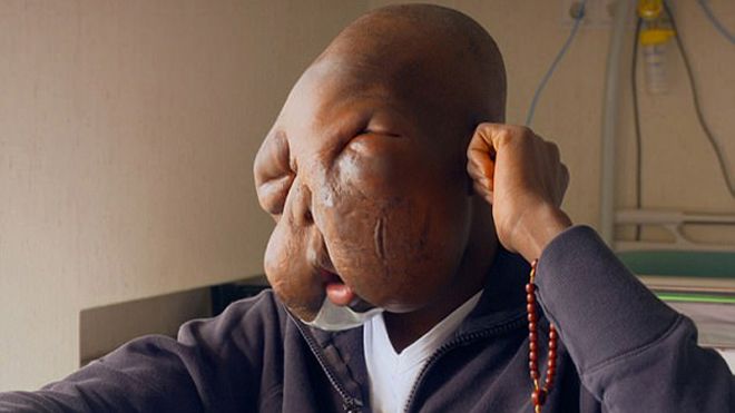 Mang khuôn mặt 'quái vật', bị mẹ bỏ rơi cậu bé tuyệt vọng muốn chết nhưng điều kỳ diệu đã xảy ra