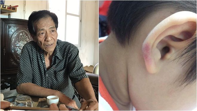 Vụ cô giáo mầm non đánh con chồng dã man: Mẹ cháu bé quay clip và trình báo công an