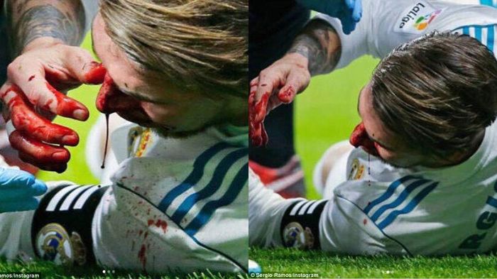 Đăng ảnh vỡ mũi kinh hoàng, Ramos 'đốn tim' fan Real bằng phát ngôn đậm chất thủ lĩnh