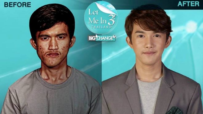 Chàng công nhân 'lột xác' sau phẫu thuật thẩm mỹ khiến mẹ đẻ cũng không nhận ra