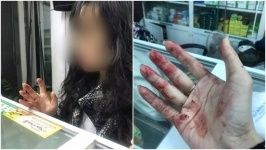 Uber chặn quyền truy cập của tài xế sau khi bị tố đánh khách nữ rách môi, bầm mặt