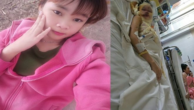 Thiếu nữ xinh đẹp ở miền Tây bị 2 kẻ lạ tạt axit hủy hoại khuôn mặt không còn tiền nằm viện