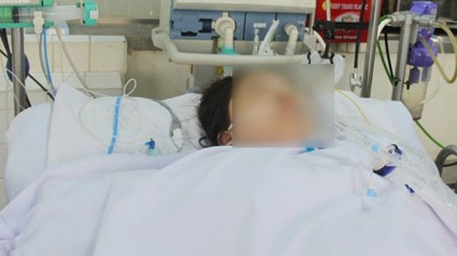 TP.HCM: Sản phụ đau đớn mất hai con song sinh vì… tiền sản giật