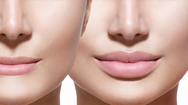 Khắc phục môi to, môi mỏng, hay hai môi không cân đối chỉ bằng mẹo trang điểm nhỏ dưới đây