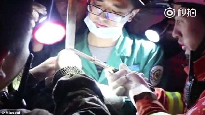 Thanh sắt dài cắm vào đầu, người đàn ông vẫn sống sót thần kì