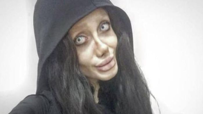 Cô gái phẫu thuật thẩm mỹ hàng chục lần để giống Angelina Jolie, và đây là kết quả khiến ai cũng hoảng hồn