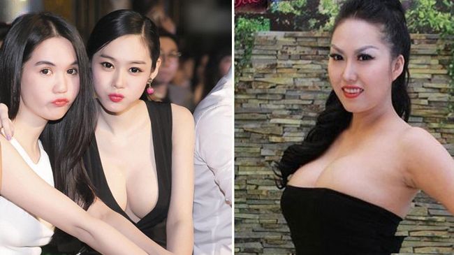 Điểm danh các mỹ nhân nâng ngực: Kẻ lên đời nhan sắc người xấu thảm họa