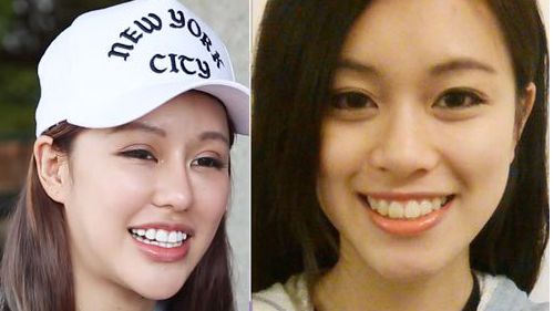 Để vừa lòng bạn trai, cô gái trẻ vốn đã xinh đẹp vẫn bất chấp phẫu thuật thẩm mỹ đến biến dạng