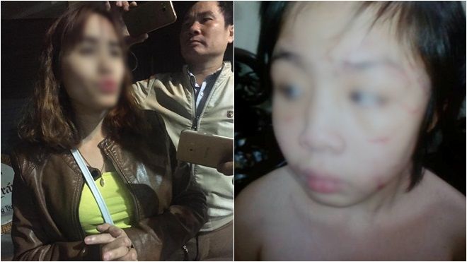 Mẹ bé trai bị bạo hành gãy xương sườn, rạn sọ não: ‘Nhìn con tôi xót quá, 2 mẹ con cứ thế ôm nhau khóc'
