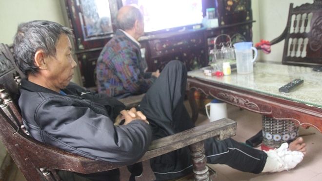 Con trai dùng gậy đánh bố mẻ bánh chè, gãy xương sườn, tổn thương 6% sức khỏe