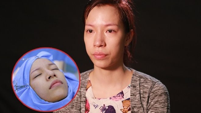 Rớt nước mắt với câu chuyện cô gái có gương mặt 'chuyển giới' quyết tâm kiếm tiền chữa bệnh cho em