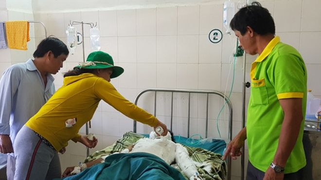 Một nam sinh phỏng nặng vì điện giật nghi do cá cược để được yêu