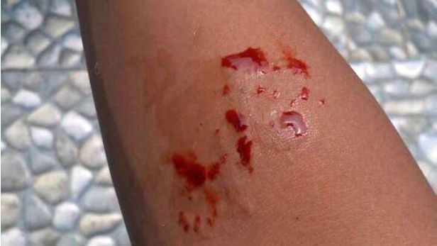 Mải mê chụp ảnh rắn để đăng lên mạng 'sống ảo', thiếu niên bị rắn cắn chết