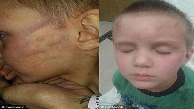 Nghịch ngợm mở quà Giáng sinh không đúng lúc, cậu bé 5 tuổi bị đánh bầm bập